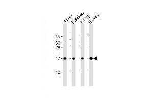 All lanes : Anti-IAL4A Antibody (Center) at 1:2000 dilution Lane 1: human brain lysate Lane 2: human kidney lysate Lane 3: human lung lysate Lane 4: human ovary lysate Lysates/proteins at 20 μg per lane. (PPIAL4A anticorps  (AA 66-92))