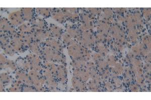 Detection of VIL in Human Stomach Tissue using Polyclonal Antibody to Villin (VIL)