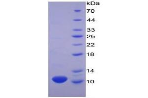 SDS-PAGE of Protein Standard from the Kit (Highly purified E. (CXCL7 Kit ELISA)