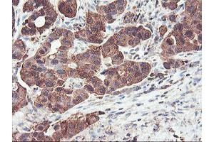 Image no. 3 for anti-phosphofructokinase, Platelet (PFKP) antibody (ABIN1500161)