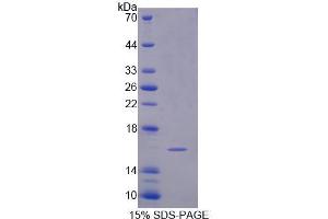 Image no. 1 for Sema Domain, Immunoglobulin Domain (Ig), Short Basic Domain, Secreted, (Semaphorin) 3C (SEMA3C) (AA 28-150) protein (His tag) (ABIN1171332)