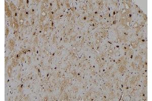 ABIN6266170 and ABIN6277192 at 1/100 staining Human heart tissue by IHC-P.