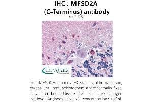 Image no. 1 for anti-Major Facilitator Superfamily Domain Containing 2A (MFSD2A) (C-Term) antibody (ABIN1736932) (MFSD2A anticorps  (C-Term))