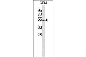 Western blot analysis in CEM cell line lysates (35ug/lane). (B4GALT4 anticorps  (AA 91-117))