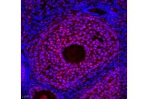 Immunofluorescence of paraffin embedded mouse ovary using ZC3H11A (ABIN7076255) at dilution of 1: 650 (400x lens) (ZC3H11A anticorps)