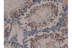 DAB staining on IHC-P; Samples: Mouse Testis Tissue (Peptide YY anticorps  (AA 30-98))