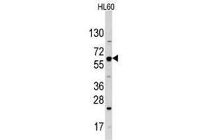 Image no. 1 for anti-Solute Carrier Family 2 (Facilitated Glucose Transporter), Member 2 (SLC2A2) (N-Term) antibody (ABIN357019)