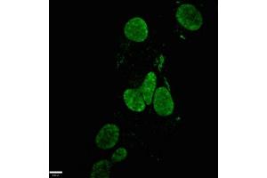 Immunofluorescence staining of Hela cells with ABIN7155816 at 1:100, counter-stained with DAPI.