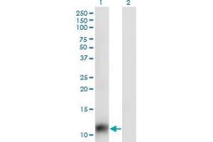 Western Blot analysis of SNAPC5 expression in transfected 293T cell line by SNAPC5 monoclonal antibody (M02), clone 5C3.