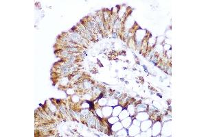 Immunohistochemistry of paraffin-embedded human colon using NOD2 Rabbit pAb (ABIN7269065) at dilution of 1:100 (40x lens). (NOD2 anticorps  (AA 611-910))