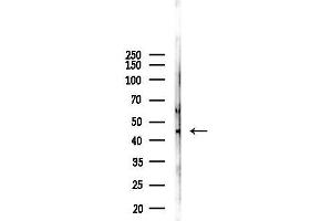 anti-Transmembrane Protease, Serine 3 (TMPRSS3) (Internal Region) antibody