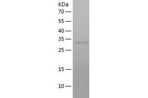 Western Blotting (WB) image for Nuclear Apoptosis Inducing Factor 1 (NAIF1) (AA 1-327) protein (His-IF2DI Tag) (ABIN7124200)