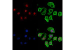 ABIN6266074 and ABIN6269267 staining HepG2 cells by IF/ICC. (YAP1 anticorps  (Internal Region))