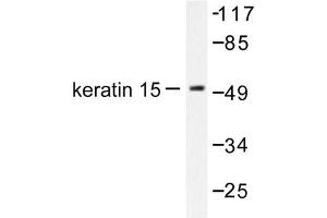 Image no. 1 for anti-Keratin 15 (KRT15) antibody (ABIN265494) (KRT15 anticorps)