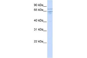 EDEM1 antibody used at 1 ug/ml to detect target protein. (EDEM1 anticorps  (N-Term))