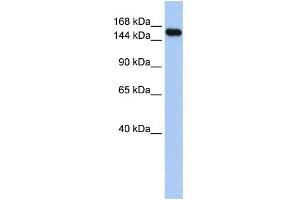 WB Suggested Anti-UBE3A Antibody Titration:  0.