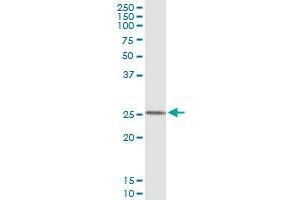 Immunoprecipitation of FXN transfected lysate using anti-FXN monoclonal antibody and Protein A Magnetic Bead , and immunoblotted with FXN MaxPab rabbit polyclonal antibody.