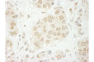 Immunohistochemistry (IHC) image for anti-Torsin A Interacting Protein 1 (TOR1AIP1) (AA 275-325) antibody (ABIN7448627)