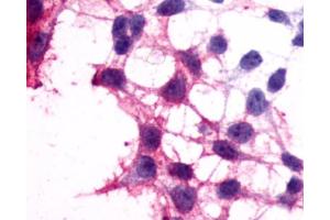 Anti-P2RY12 / P2Y12 antibody immunocytochemistry (ICC) staining of HEK293 human embryonic kidney cells transfected with P2RY12 / P2Y12. (P2RY12 anticorps  (N-Term))