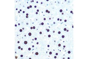 Immunohistochemistry of paraffin-embedded mouse liver using hnRNP U Rabbit mAb (ABIN1679689, ABIN3018741, ABIN3018742 and ABIN7101656) at dilution of 1:100 (40x lens).