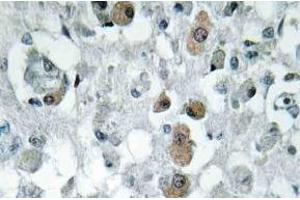 Immunohistochemistry (IHC) analyzes of GNPAT antibody in paraffin-embedded human brain tissue.