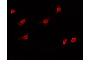 ABIN6266827 staining A549 cells by IF/ICC. (DKC1 anticorps  (Internal Region))