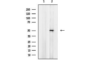 Western blot analysis of lysates from COLO cells, using Cytochrome P450 4 Antibody.