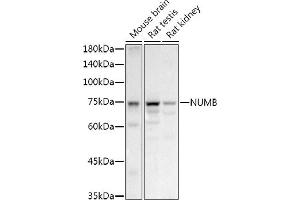Western blot analysis of extracts of various cell lines, using NUMB antibody (ABIN6129424, ABIN6144943, ABIN6144944 and ABIN6224990) at 1:1000 dilution.