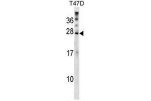 Western blot analysis in T47D cell line lysates (35µg/lane) using RNF4 Antibody (C-term) Cat. (RNF4 anticorps  (C-Term))