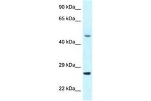 Image no. 1 for anti-Cyclin-Dependent Kinase 20 (CDK20) (N-Term) antibody (ABIN6747693) (CCRK anticorps  (N-Term))