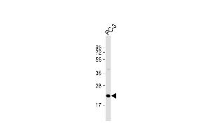 Anti-OBEC3C Antibody (C-Term) at 1:2000 dilution + PC-3 whole cell lysate Lysates/proteins at 20 μg per lane. (APOBEC3C anticorps  (AA 143-177))