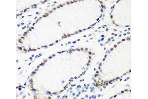 Immunohistochemistry of paraffin-embedded Human stomach using HTATSF1 Polyclonal Antibody at dilution of 1:100 (40x lens).