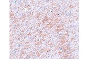 Immunohistochemical staining of rat brain tissue with DCLK2 polyclonal antibody  at 5 ug/mL dilution. (DCLK2 anticorps  (C-Term))