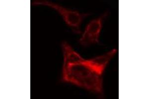ABIN6266643 staining Hela cells by IF/ICC.