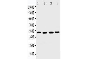 Anti-DR5 antibody, Western blotting Lane 1: HELA Cell Lysate Lane 2: MM231 Cell Lysate Lane 3: SGC Cell Lysate Lane 4:  Cell Lysate