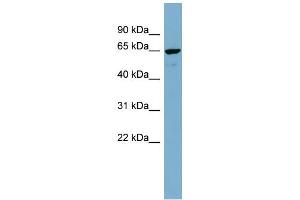 WB Suggested Anti-NOP5 Antibody Titration: 0. (NOP58 anticorps  (Middle Region))