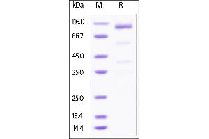 Human Glypican 3 / GPC3, Fc Tag, low endotoxin on SDS-PAGE under reducing (R) condition.