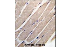 Forlin-fixed and paraffin-embedded hun skeletal muscle tissue reacted with P2K4 Antibody  (ABIN392418 and ABIN2842027) , which was peroxidase-conjugated to the secondary antibody, followed by DAB staining.