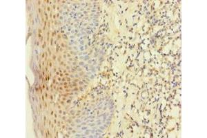 Immunohistochemistry of paraffin-embedded human tonsil tissue using ABIN7145011 at dilution of 1:100 (YME1L1 anticorps  (AA 1-240))