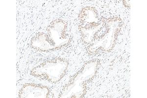 Immunohistochemistry (IHC) image for anti-Exportin 1 (XPO1) (C-Term) antibody (ABIN7453427) (XPO1 anticorps  (C-Term))
