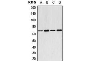 Western blot analysis of ARMCX2 expression in MCF7 (A), SP2/0 (B), PC12 (C), rat heart (D) whole cell lysates. (ARMCX2 anticorps  (Center))