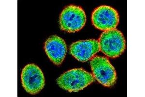 Confocal immunofluorescent analysis of IKK beta antibody with HeLa cells followed by Alexa Fluor 488-conjugated goat anti-rabbit lgG (green).