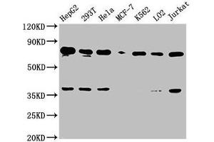 Western Blot Positive WB detected in: HepG2 whole cell lysate, 293T whole cell lysate, Hela whole cell lysate, MCF-7 whole cell lysate, K562 whole cell lysate, LO2 whole cell lysate, Jurkat whole cell lysate All lanes: UBC antibody at 1:2000 Secondary Goat polyclonal to rabbit IgG at 1/50000 dilution Predicted band size: 78 kDa Observed band size: 78 kDa (UBC anticorps  (AA 19-36))