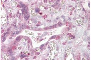 Anti-NFATC4 antibody IHC staining of human placenta. (NFATC4 anticorps  (AA 953-965))