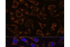 Immunofluorescence analysis of L929 cells using GTPBP8 Polyclonal Antibody at dilution of 1:100. (GTPBP8 anticorps)