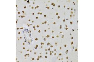 Immunohistochemistry of paraffin-embedded rat brain using DNMT3A Antibody (ABIN1872325) at dilution of 1:100 (40x lens). (DNMT3A anticorps)