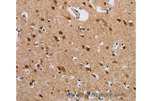 Immunohistochemistry of Human brain  using IL19 Polyclonal Antibody at dilution of 1:40 (IL-19 anticorps)