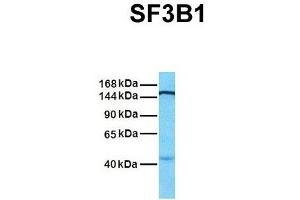 Host:  Rabbit  Target Name:  SF3B1  Sample Tissue:  Human MCF7  Antibody Dilution:  1.