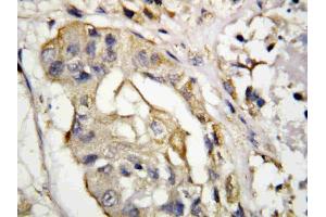 IHC analysis of sCD40L using anti- sCD40L antibody .