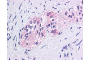 Immunohistochemistry with Colon, myenteric plexus tissue at an antibody concentration of 5. (EGR1 anticorps  (N-Term))